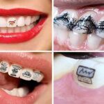 سکھر: اونٹ کی ٹانگ کاٹنے کا دوسرا ملزم بھی گرفتار