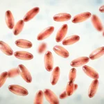 روس سے پاکستان طاعون منتقلی کا خطرہ : وزارت صحت نے تفصیل بتا دی